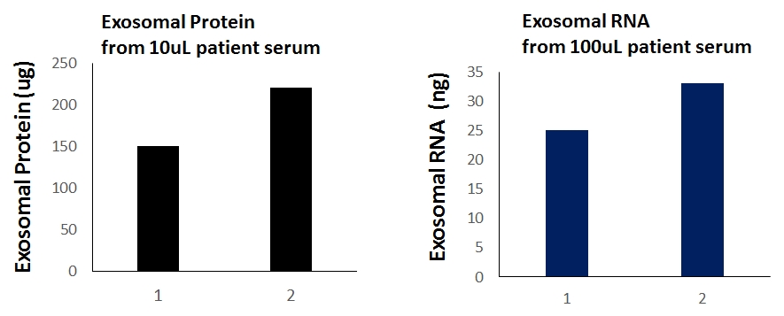 cancer exosome biomarkers, exosomes cancer