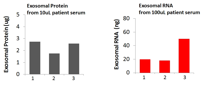 cancer exosome biomarkers, exosomes cancer