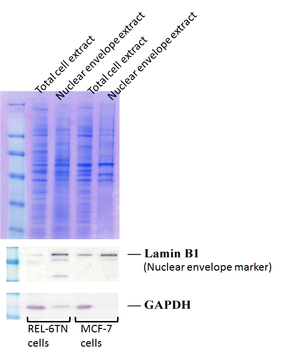 nuclear membrane protein extraction kit