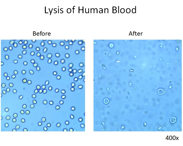 Red Blood Cell Lysis, ACK Lysing Buffer