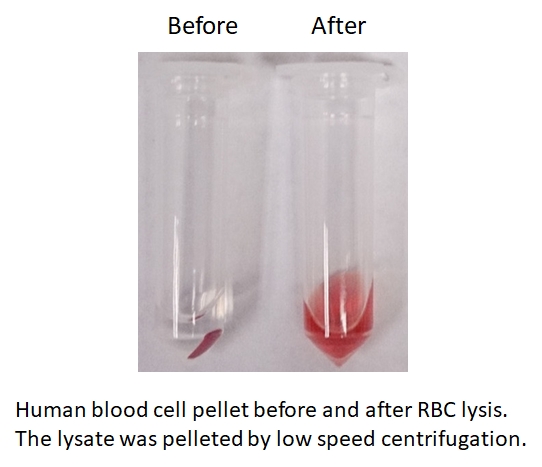 RBC lysing buffer