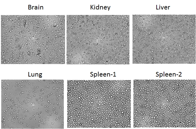 Tissue (tumor) dissociation kit, single cells isolation kit