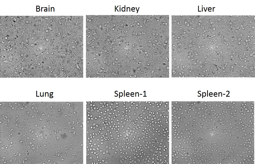Tissue (tumor) dissociation kit, single cells isolation kit
