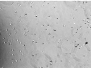 human peripheral blood CD14+ cells